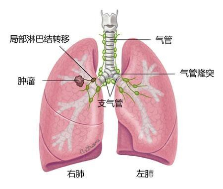 双肺门位置图图片