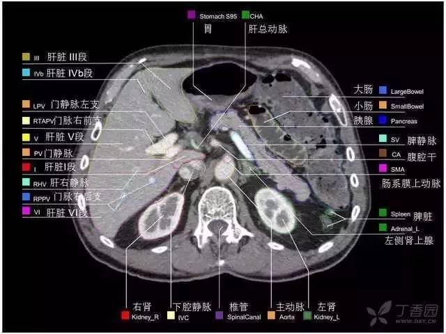 医学笔记︱高清版腹部CT：（上）