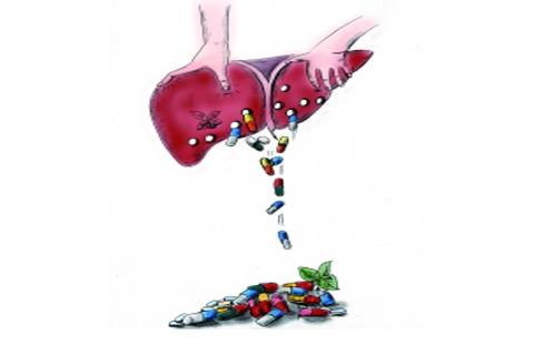 是藥物都可能導致藥物性肝損傷,排第1位藥物根本想不到