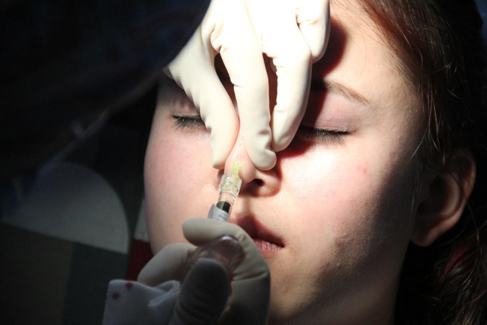 注射鼻整形需要注意哪些