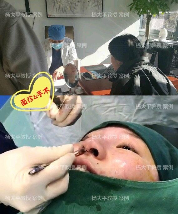 微晶瓷的主要成分为羟基磷灰石钙,与人体骨骼的矿物成分基本相似,因此