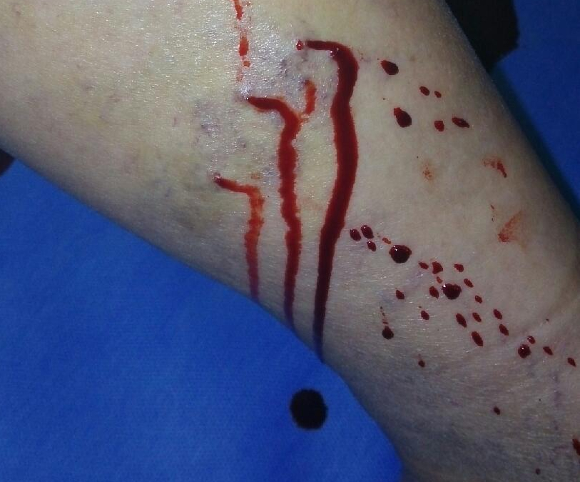 这些小病不用吃药用针可能好得更快