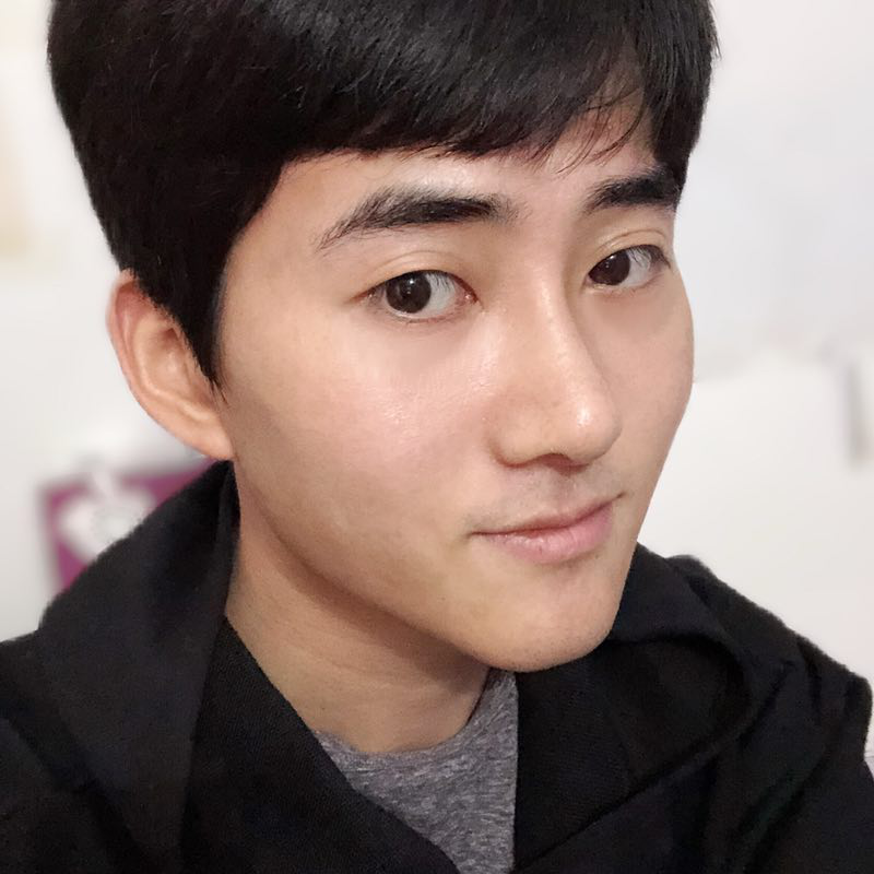 李劲良真人案例鼻综合术后15天成功晋级小鲜肉