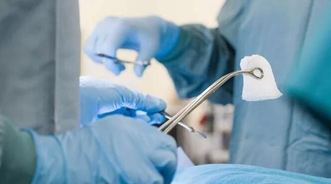 激光电灼治疗尖锐湿疣效果好吗