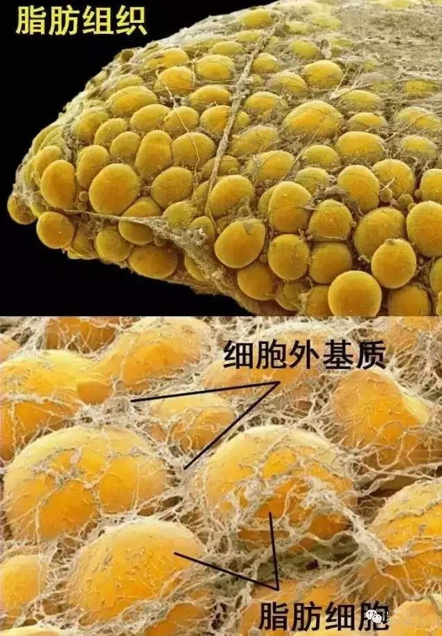 自体脂肪丰胸细胞移植存活率受什么影响?如果细胞坏死会发生什么