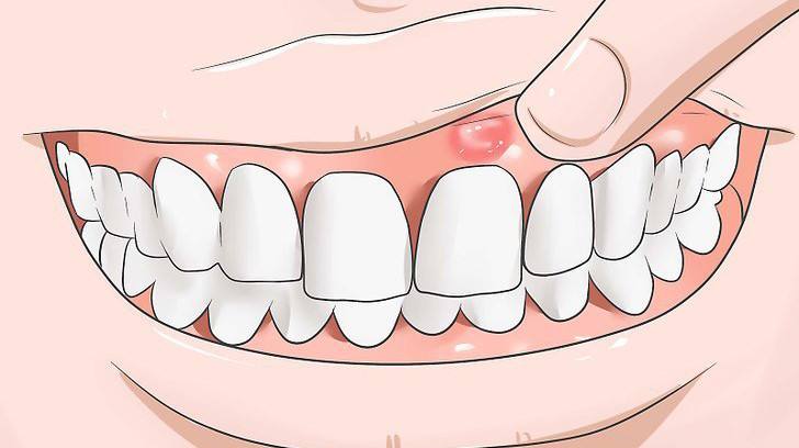 全身的白血病症状表现为:牙龈自发性出血,局部或全身淋巴结肿大等