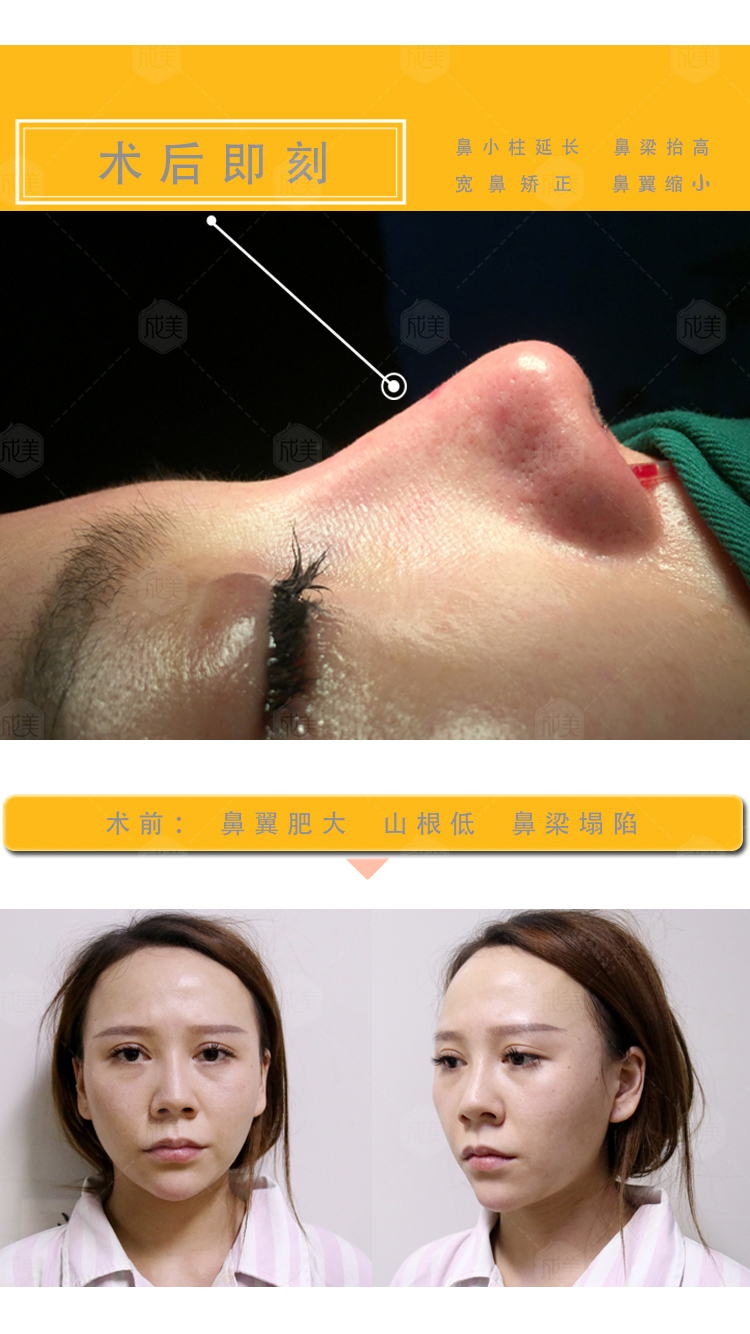 冯春雨-爱问医生