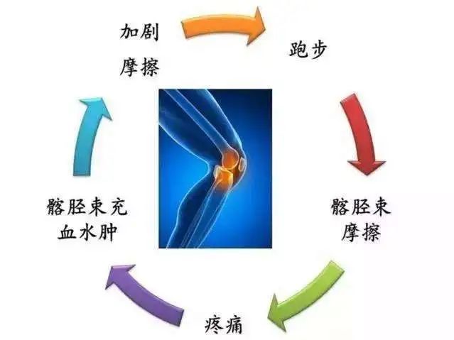 也叫跑步膝,是指髂胫束和股骨外上髁过度摩擦,导致韧带或滑囊炎症的