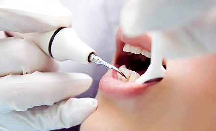 为什么要定期洗牙