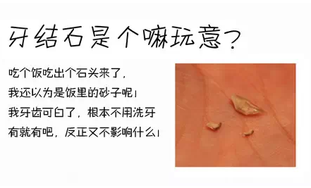 牙结石是如何形成的