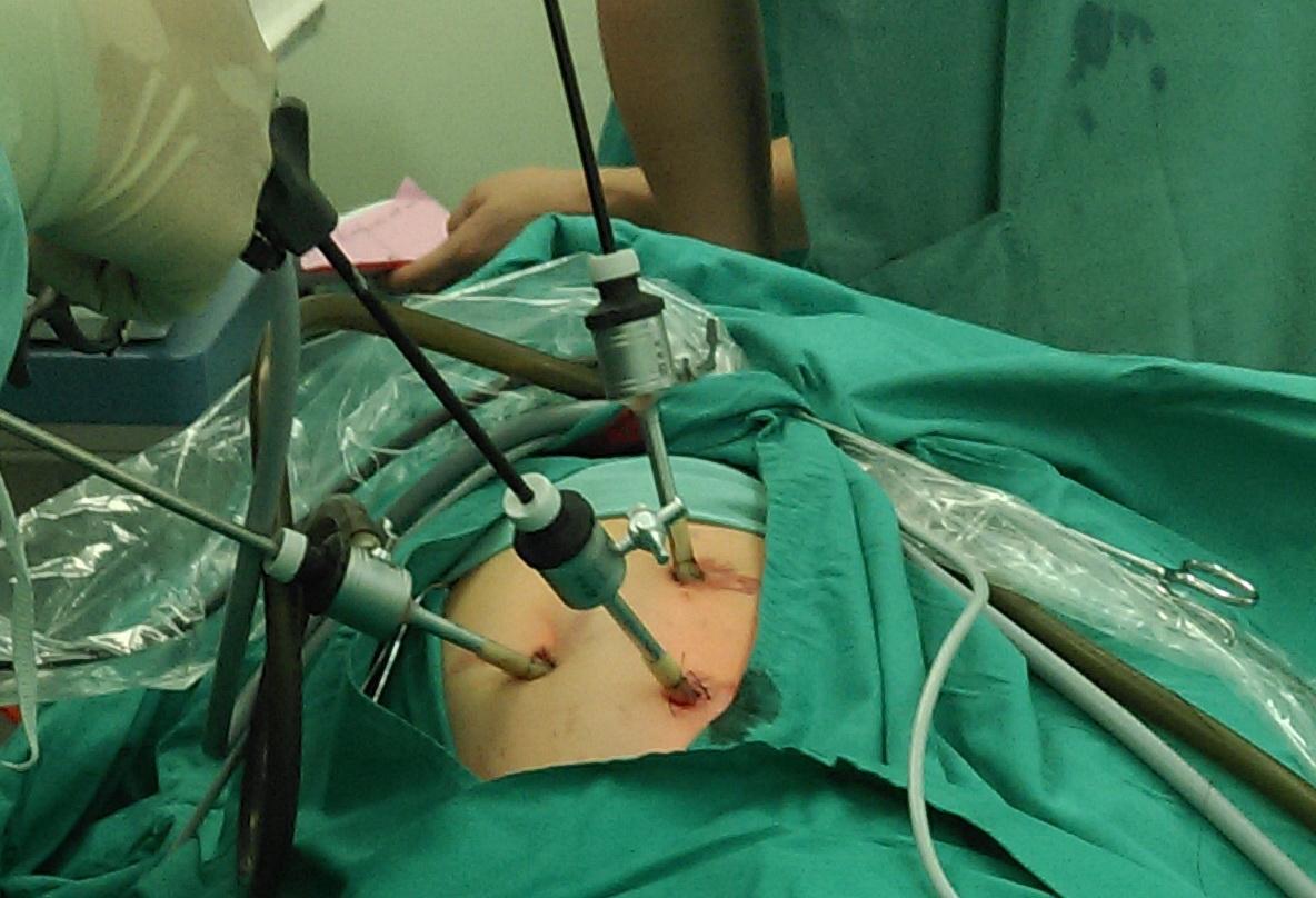 宝宝患了肾积水怎么办?