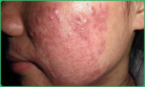 李志忠主治医师-爱问医生