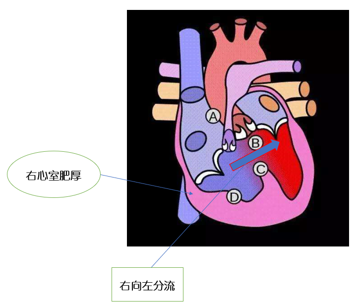 右心室内部结构图片