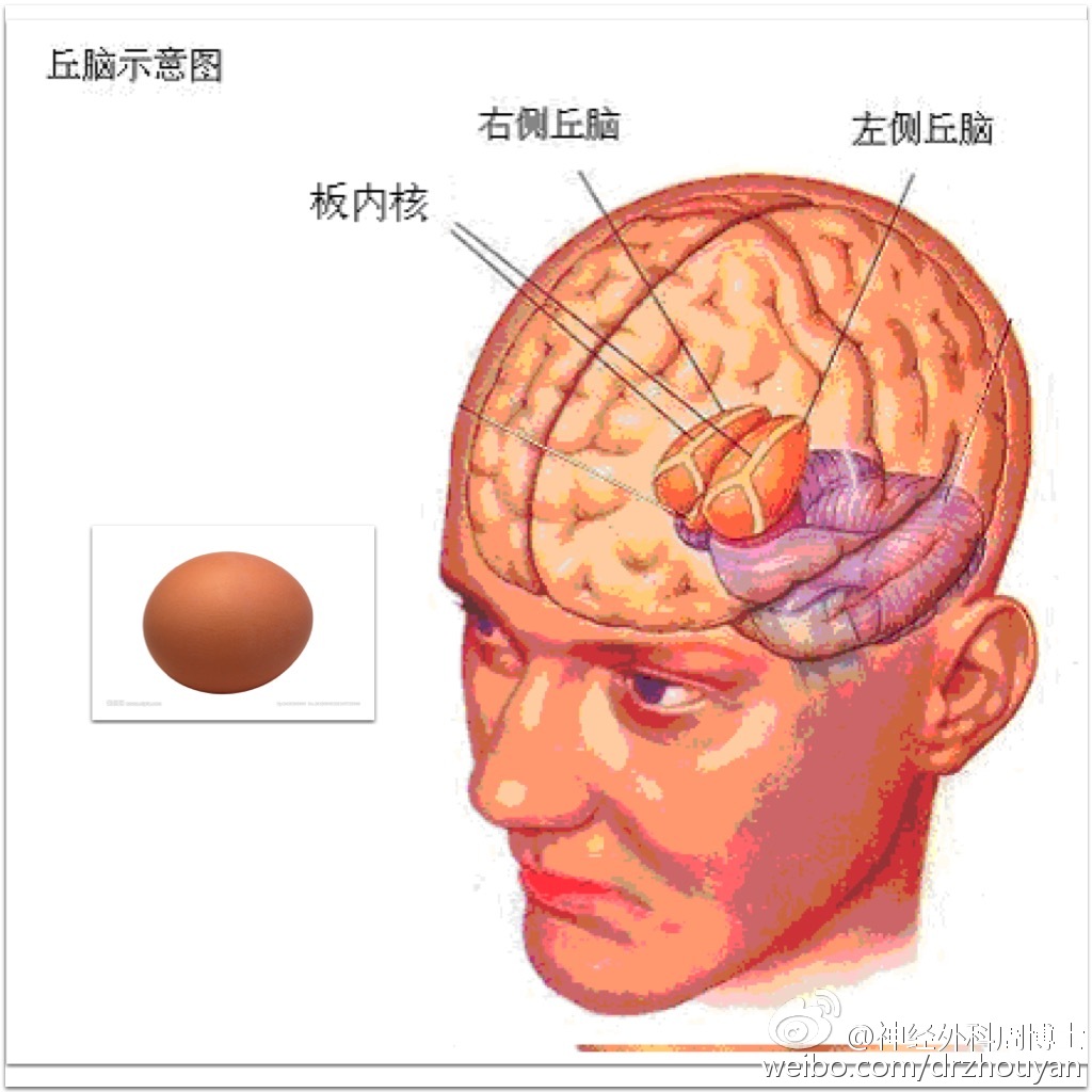 脑子在头部位置图图片