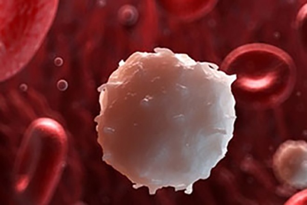 骨髓增殖性肿瘤(mpn),是一组克隆性造血干细胞疾病外周血表现为一种或