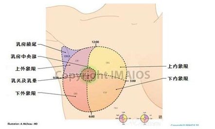 面對哺乳期乳房腫脹,你的做法正確嗎?