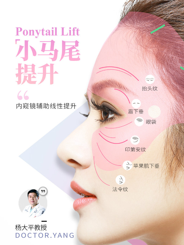 中上面部抗衰攻略——"小马尾"提升术