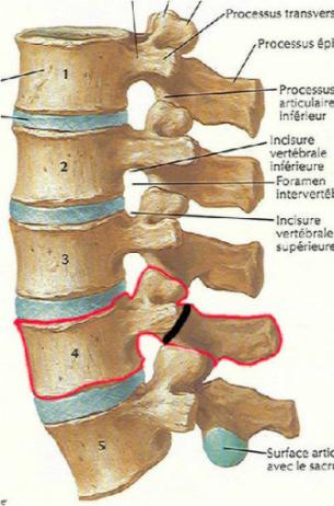 腰椎椎弓峡部图片图片