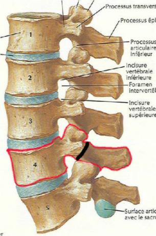 腰椎弓峡部图片