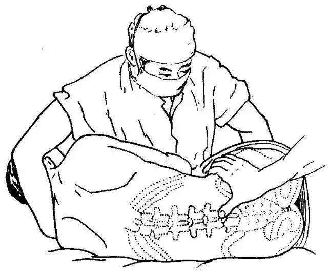 家长:医生让孩子做腰穿,应该注意哪些?史淑荣工作室整理