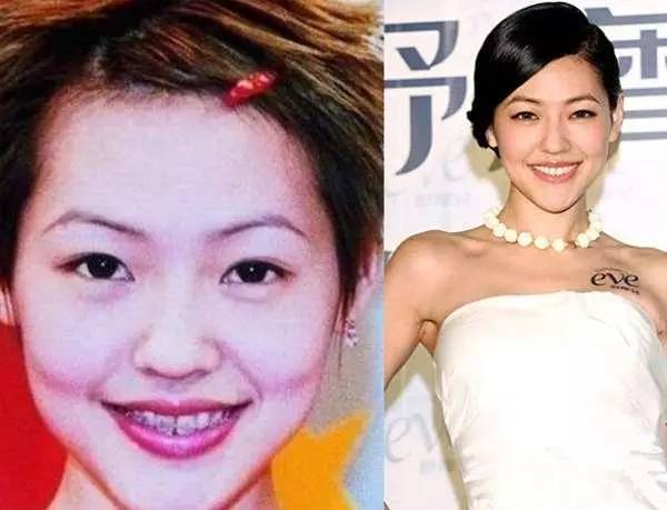 羡慕刘涛一口白牙?先看看她“美容冠”血泪史…