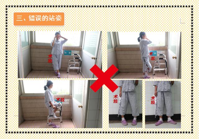 独家南方关节外科人工髋关节置换术后体位指导画册值得收藏