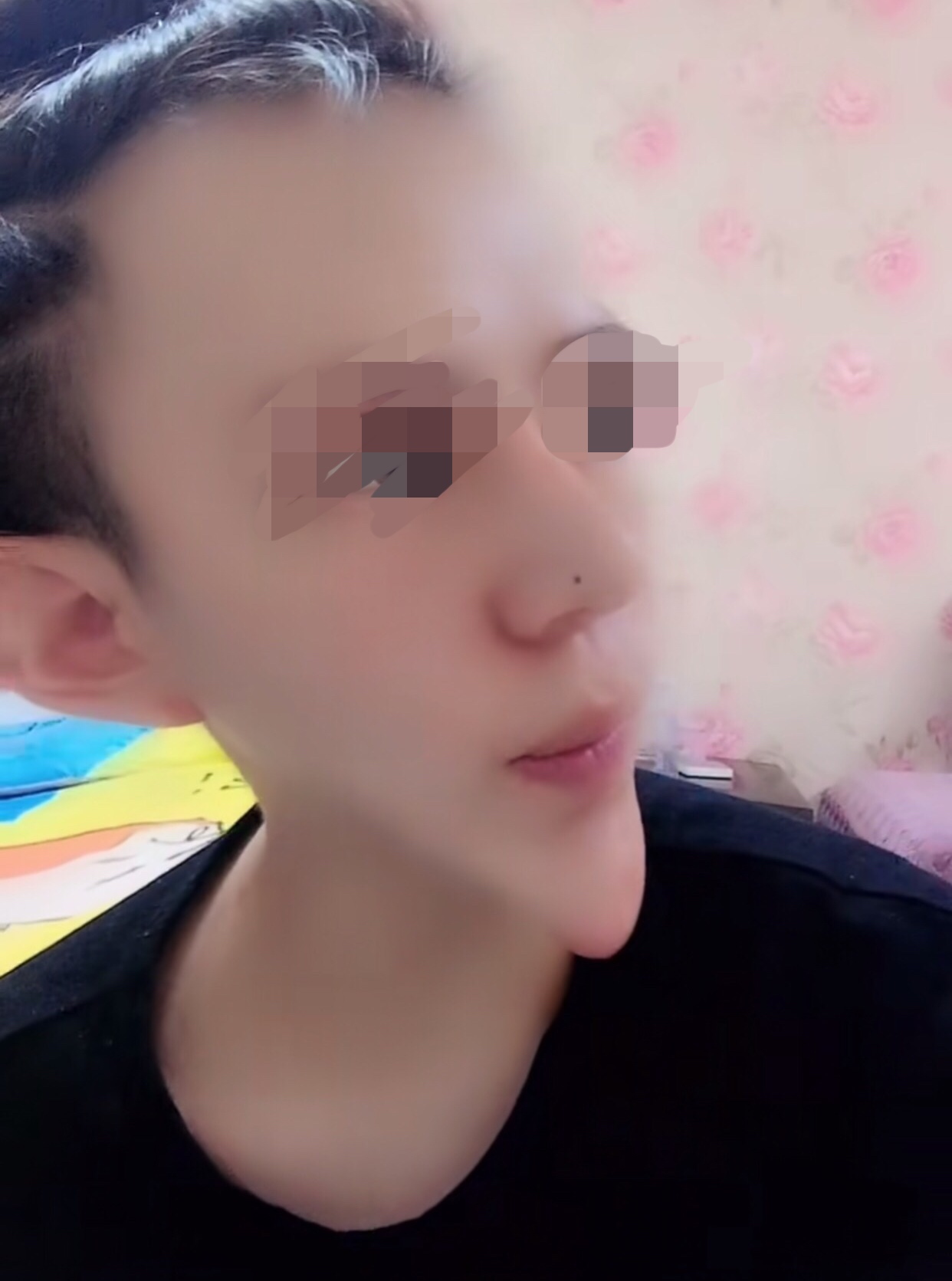 整形出现寿星公额头该如何避免