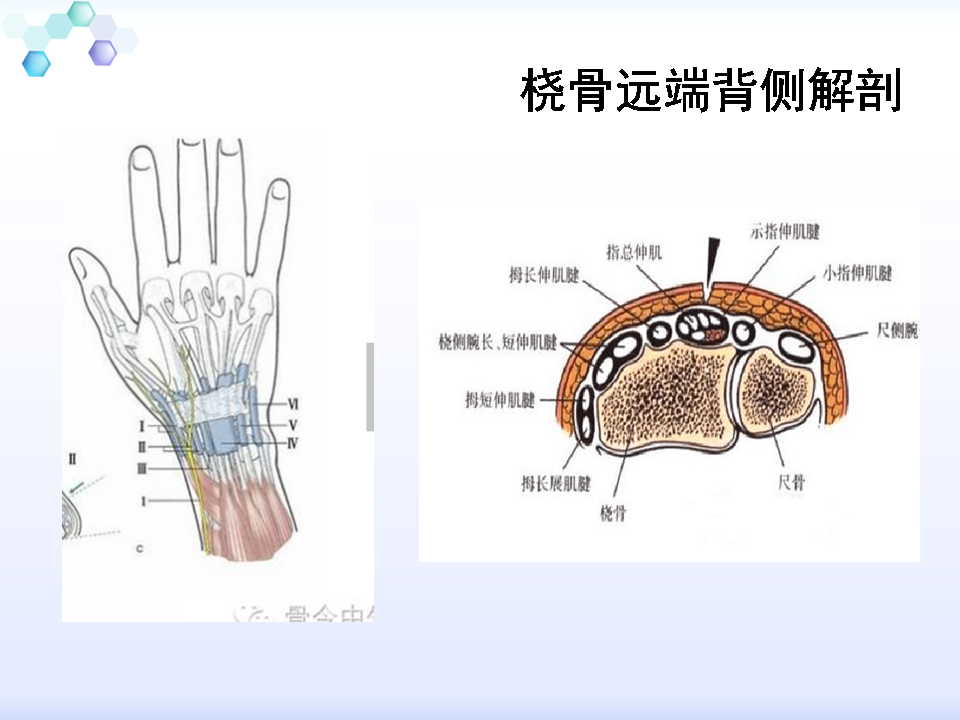手术桡骨远端背侧骨折手术入路