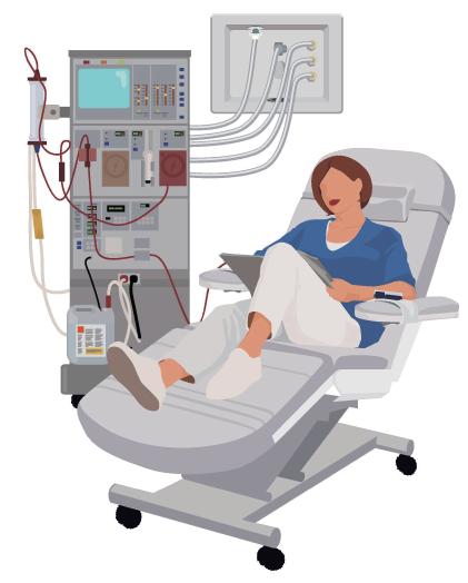 临床透析治疗一般分为两类,一类为血液透析法,一类为腹膜透析法.