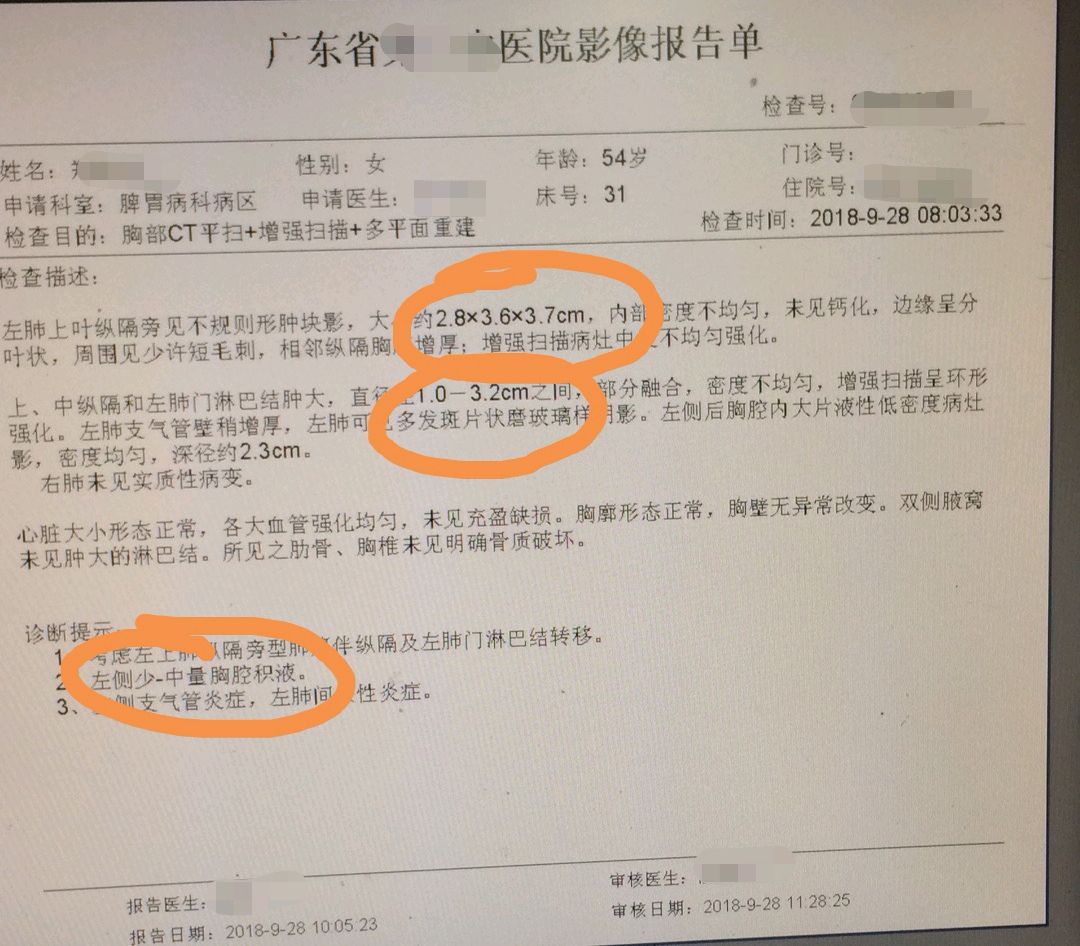 54歲的阿姨胸悶又是晚期肺癌國慶節的喜悅應如何維護