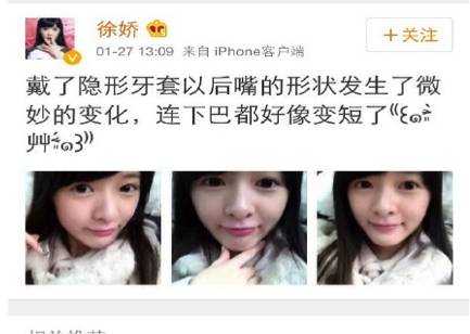 羡慕刘涛一口白牙?先看看她“美容冠”血泪史…