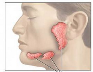 唾液腺肿大症状图片