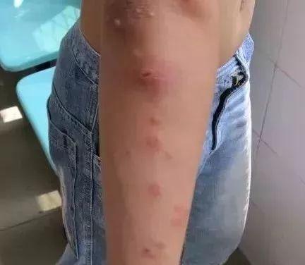 小心这种病毒在广东高发这动作千万别做