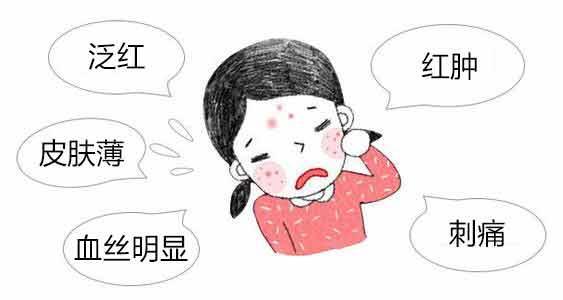 (图片源于网络)面部潮红可分为生理性和病理性生理性面部潮红称"红