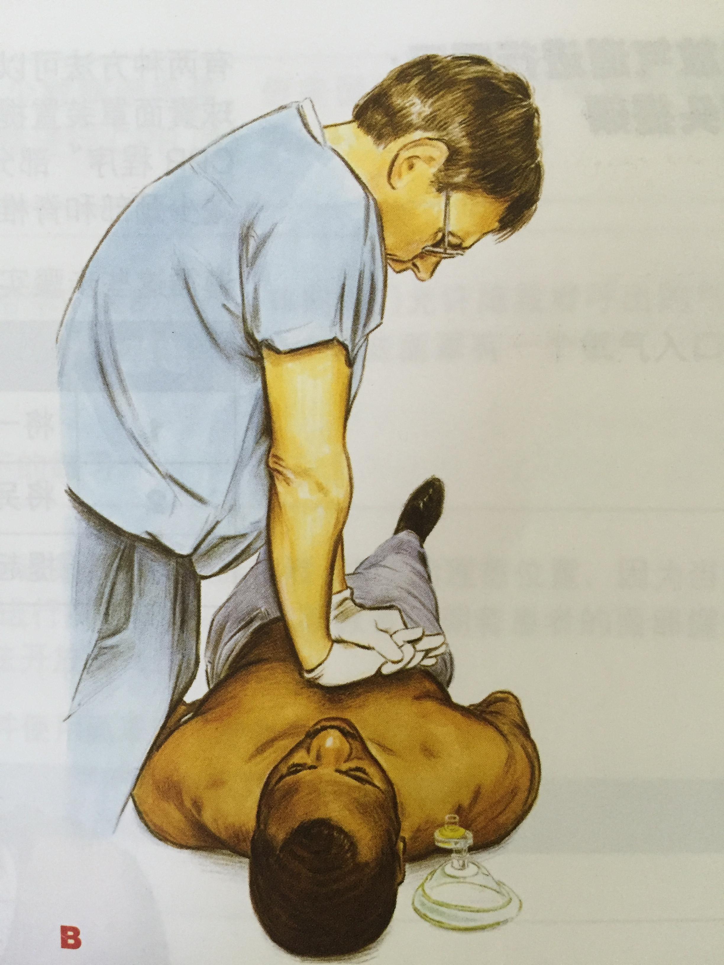 野外成功救人后对cpr急救特别强调5点