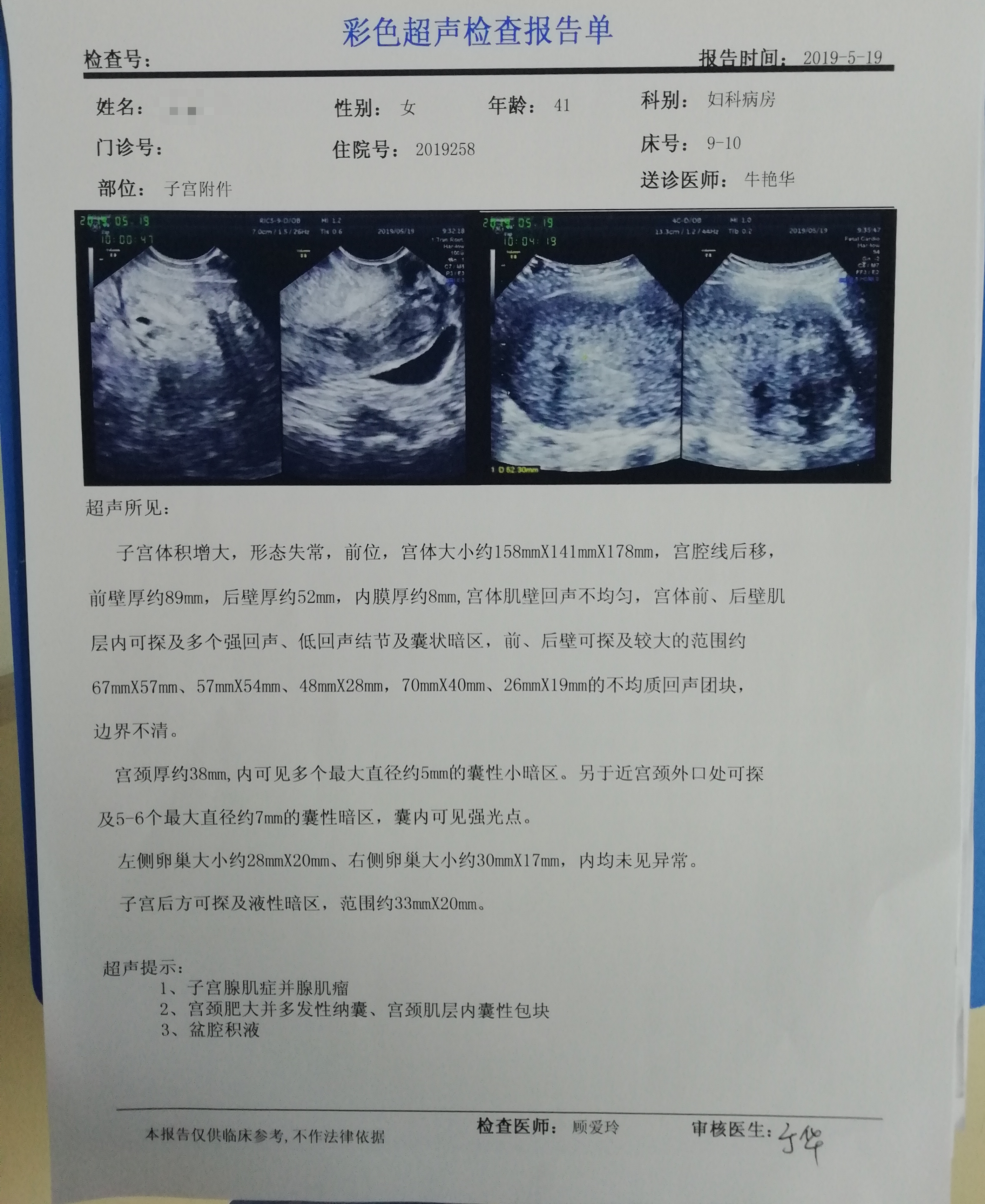 子宫腺肌症抓紧治,保子宫,怀孕都不难