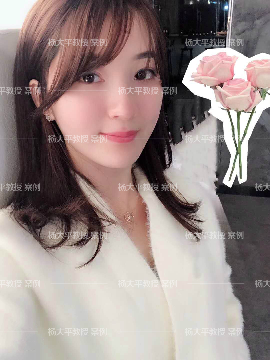 又一个童颜针受害者