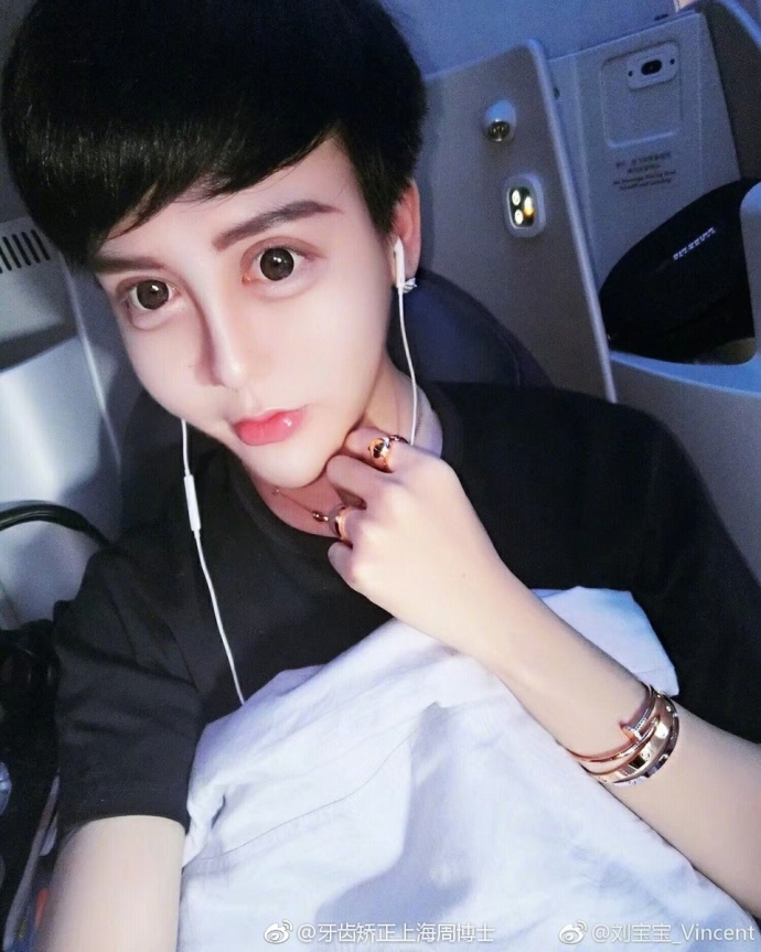 你所想知道关于"牙套脸"的一切!