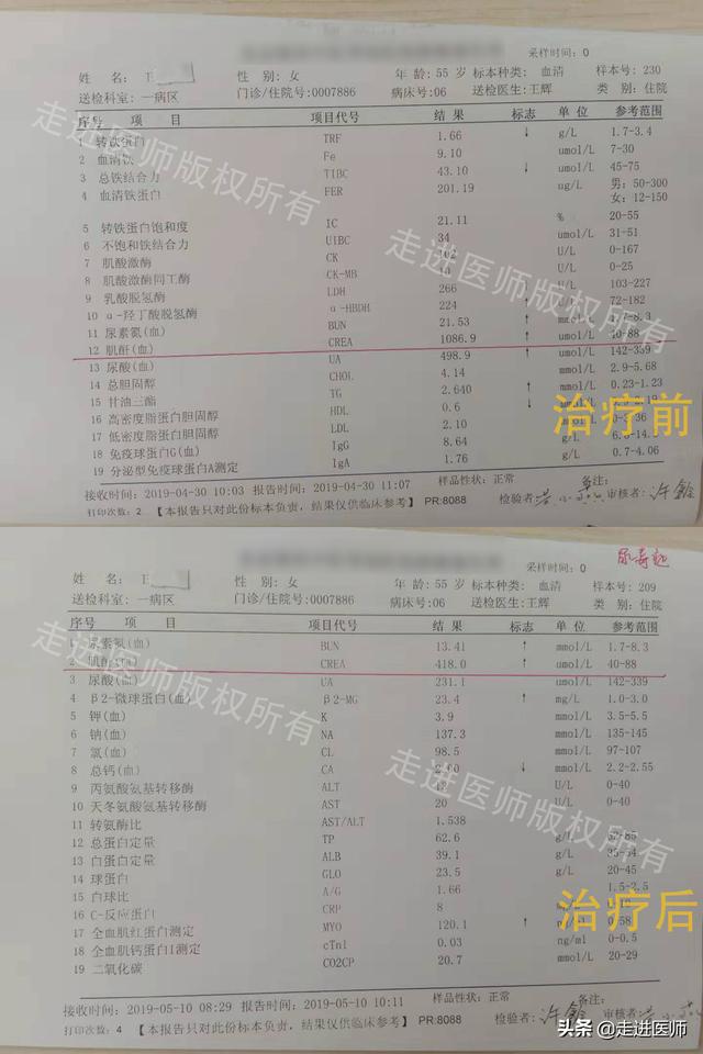 尿蛋白難消除牢記以下2句話晨起常吃2種食物腎也越來越好