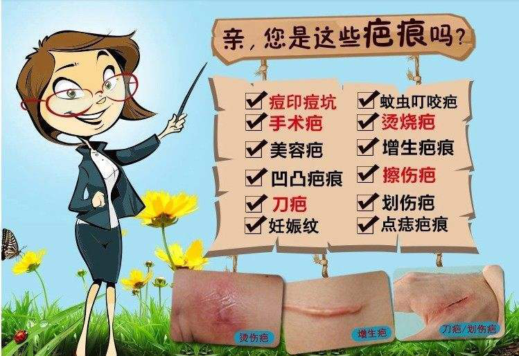 疤痕的治疗以及护理知识,分享一下