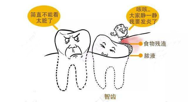 医生，我的智齿要拔吗？拔了会瘦脸吗？