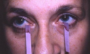 schirmer泪液测试