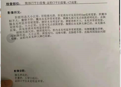 胰腺癌的ct图片与报告图片