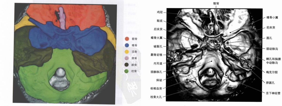 (颅底1(颅底2)