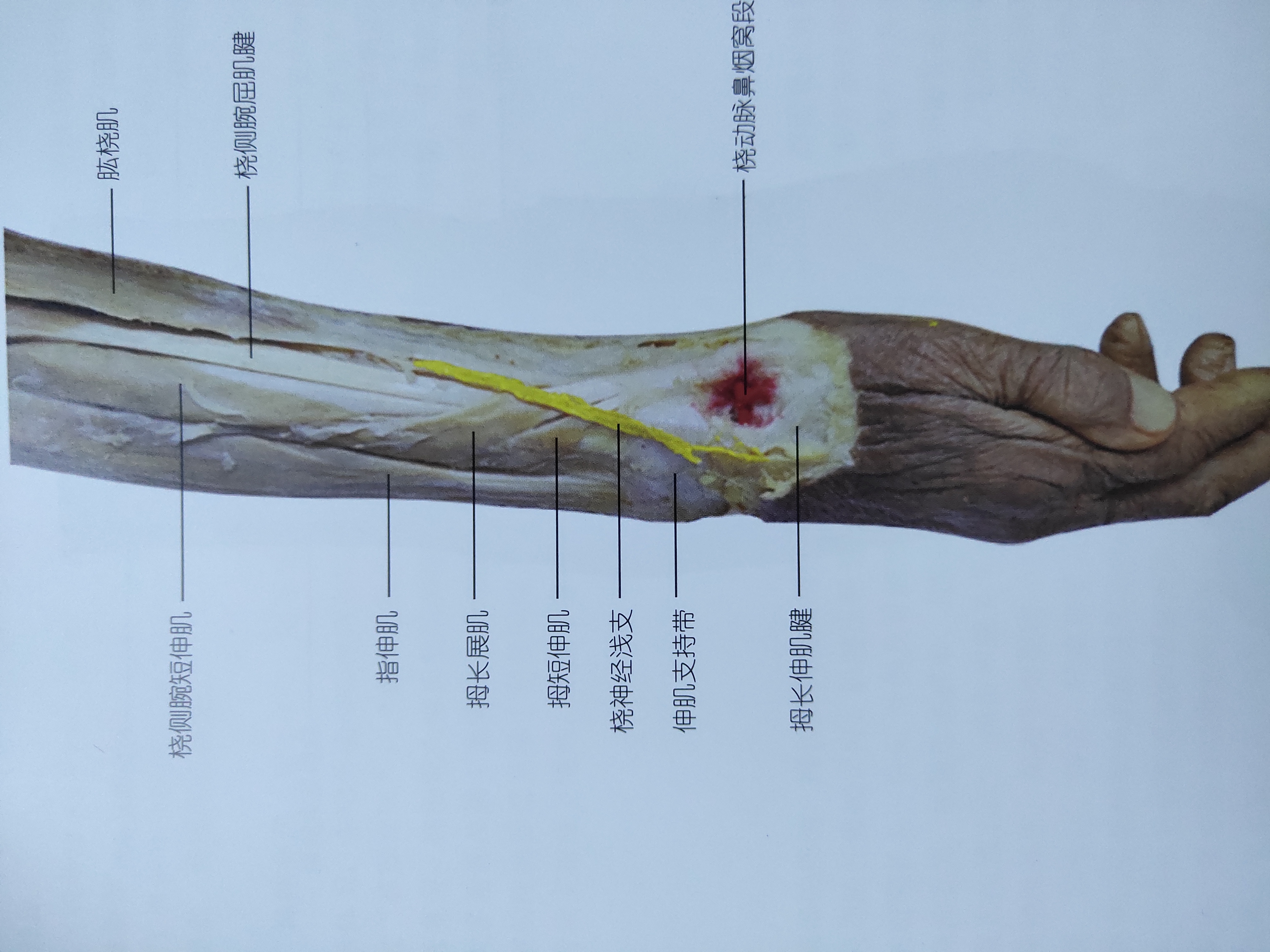 尺骨桡骨解剖图茎突图片