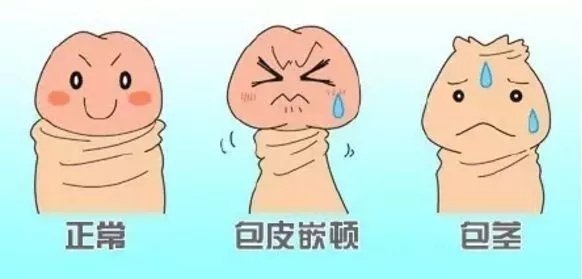 新婚初夜后,丁丁竟然卡住了怎么办?