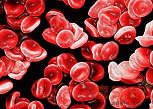 减少的疾病,即可确定诊断,对少数不典型病例,可借助于观察病态造血