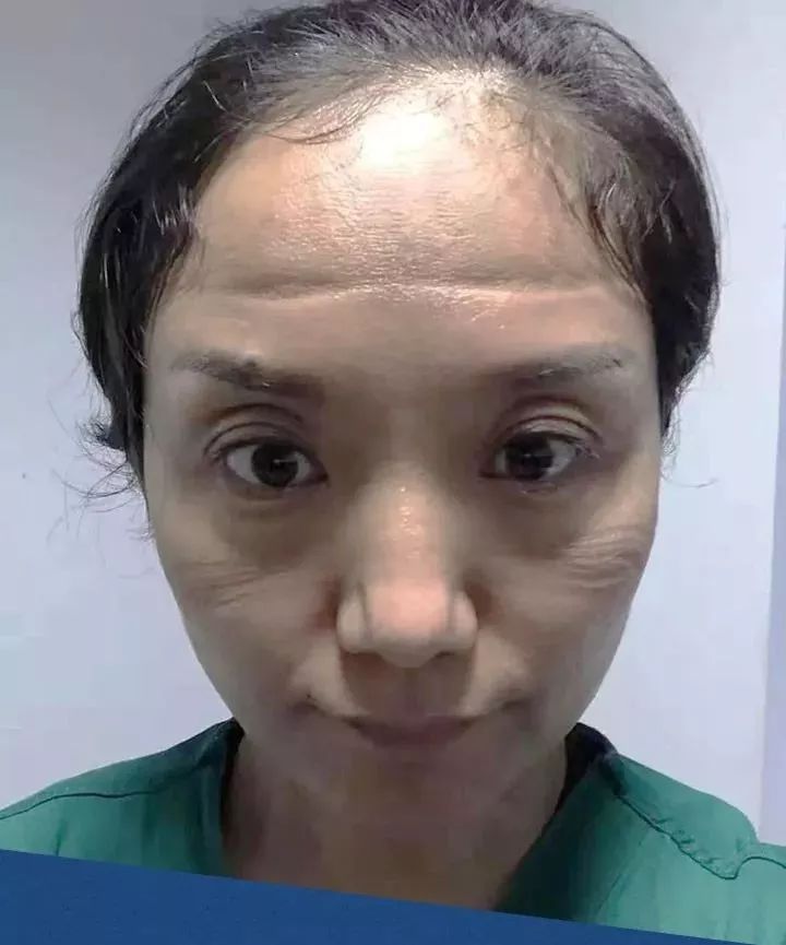 警惕"口罩脸"!不要让它毁了你的肌肤!