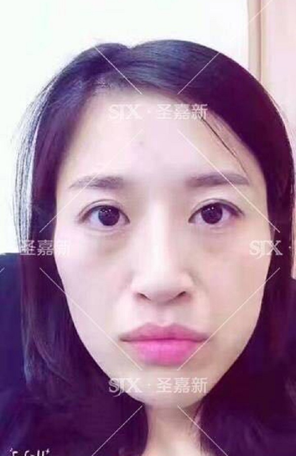 着实让人欢喜不起来就像我们常说的苦瓜脸整体会给人一种面相很苦的