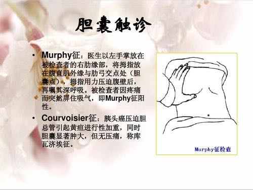 如果进一步检查确诊了胰头癌或者壶腹癌,手术时可以发现胆囊明显肿大